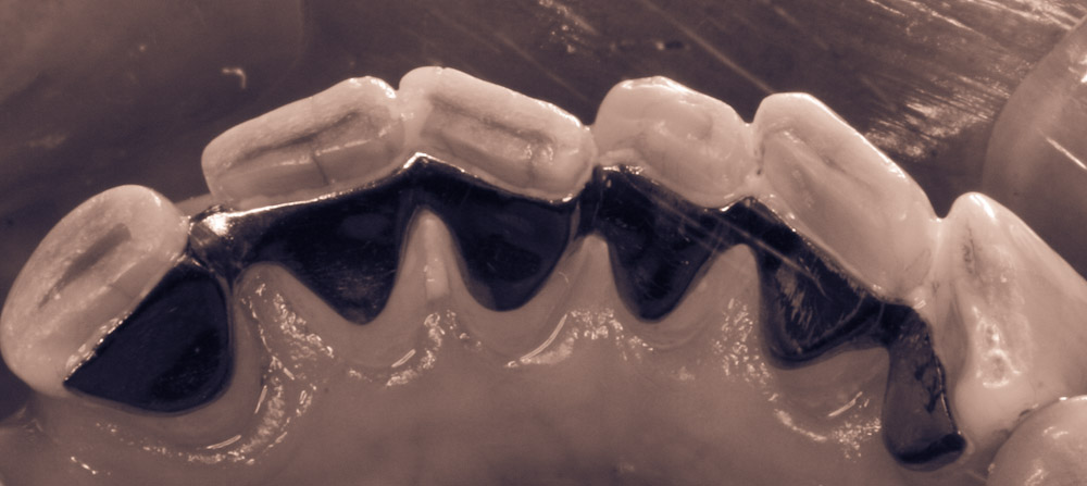row of teeth hurt