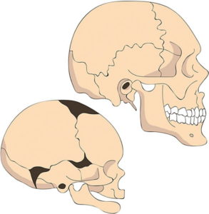 human skull growth