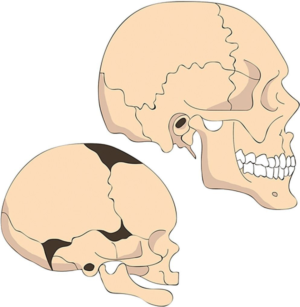 human skull growth